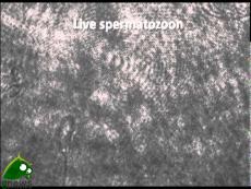 CNR, Primo video 3-D di spermatozoi umani viventi